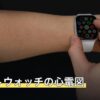 スマートウォッチの心電図